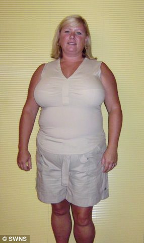 Weight Loss Gastric Band Hypnotherapy Case